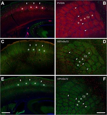 Distribution Patterns of Three Molecularly Defined Classes of GABAergic Neurons Across Columnar Compartments in Mouse Barrel Cortex